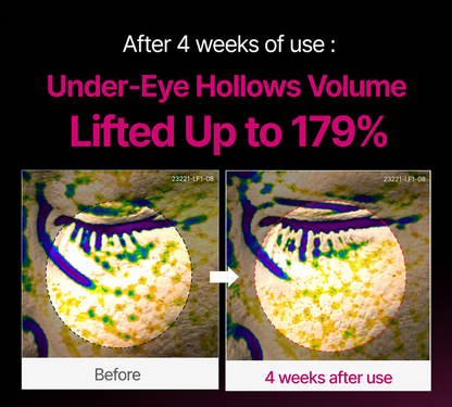 🔥LAST DAY 50% OFF!!Ptolcno Korean Calcium Dark Spot Eye Cream
